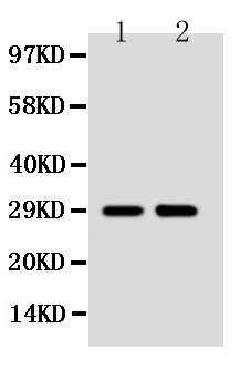 1 - Anti-SSX2 Antibody ABO10612