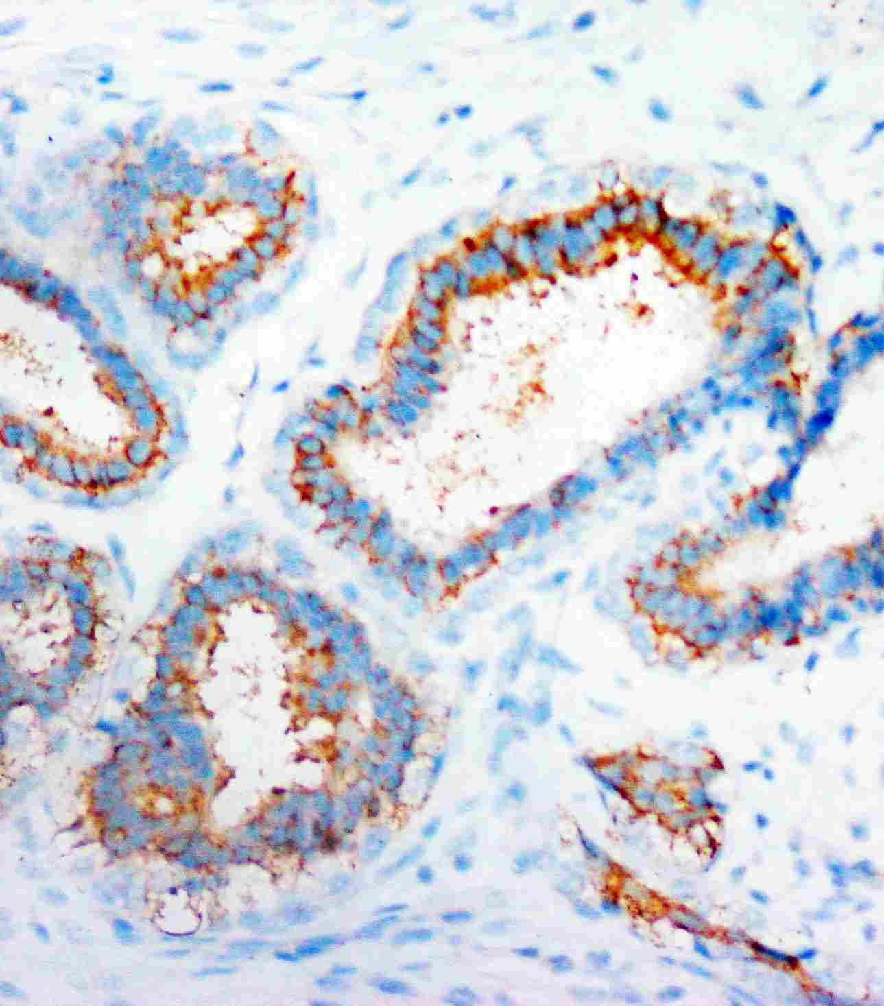 2 - Anti-CXCR4 Antibody ABO10613