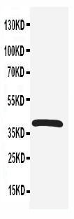 1 - Anti-CXCR4 Antibody ABO10613