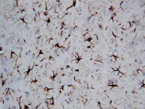 2 - Anti-GFAP Antibody ABO10614