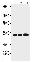 1 - Anti-GFAP Antibody ABO10614