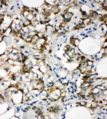 2 - Anti-Cytokeratin 8 Antibody ABO10615