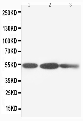 1 - Anti-Cytokeratin 8 Antibody ABO10615