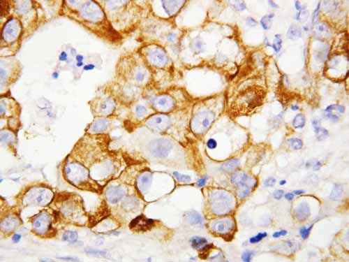 2 - Anti-sTNFsR II Antibody ABO10617