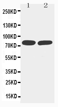 1 - Anti-sTNFsR II Antibody ABO10617