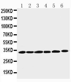 1 - Anti-Cyclin D1 Antibody ABO10619