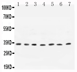 1 - Anti- Cyclin D1 Antibody ABO10620