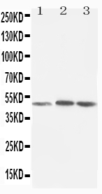 1 - Anti-LXR Alpha Antibody ABO10621