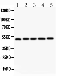 1 - Anti-LXR Alpha Antibody ABO10622