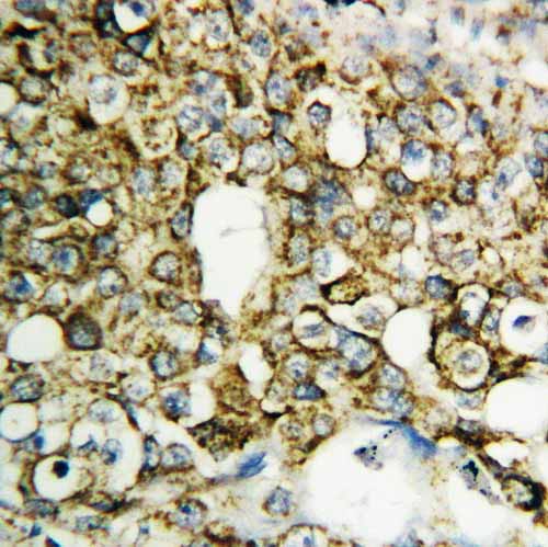 2 - Anti-TFPI2 Antibody ABO10624