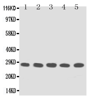 1 - Anti-TFPI2 Antibody ABO10624