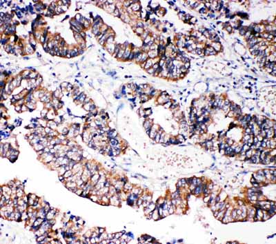2 - Anti-Caspase-3 (P10) Antibody ABO10627