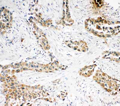 2 - Anti-Caspase-3 (P10) Antibody ABO10627