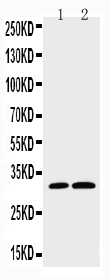 1 - Anti-Caspase-3 (P10) Antibody ABO10627