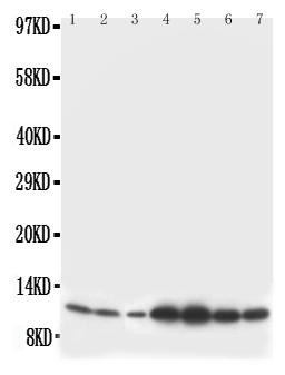 1 - Anti-S100 Beta Antibody ABO10629