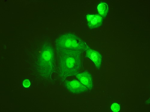 8 - Anti-TNFAIP1 Antibody ABO10631