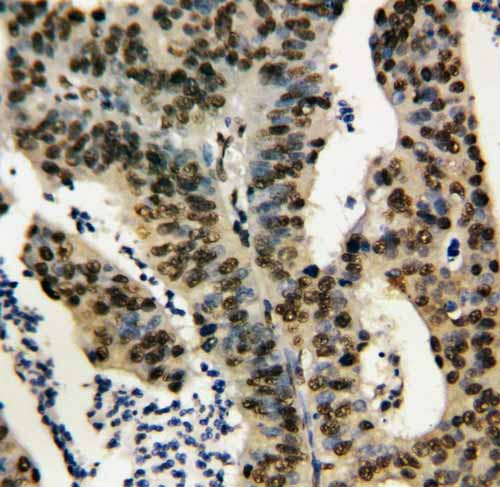 2 - Anti-TNFAIP1 Antibody ABO10631