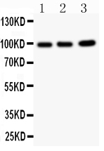 1 - Anti-TNFAIP1 Antibody ABO10631