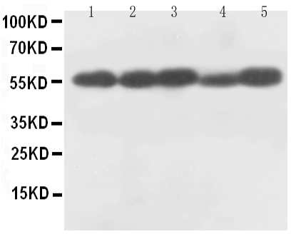1 - Anti-Caspase-8 (p18) Antibody ABO10634
