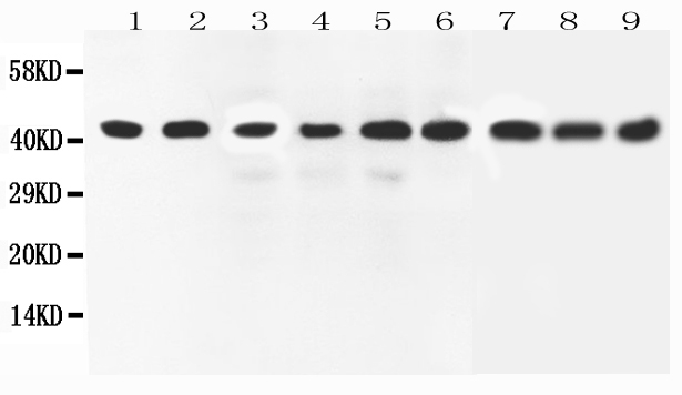 1 - Anti-ERK2 Antibody ABO10637
