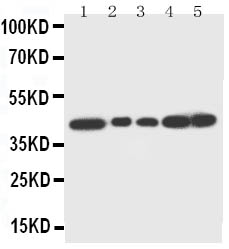 1 - Anti-Decorin Antibody ABO10639