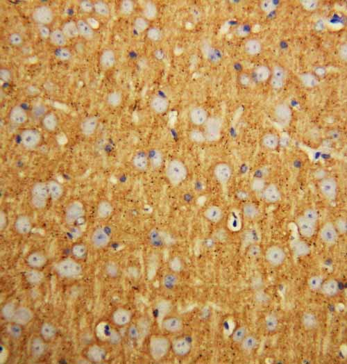 2 - Anti-SNAP25 Antibody ABO10640