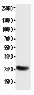 1 - Anti-SNAP25 Antibody ABO10640