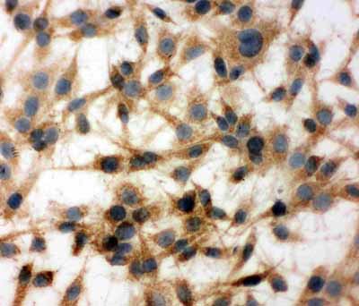 8 - Anti-MTCO1 Antibody ABO10642