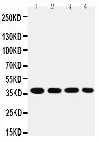 1 - Anti-MTCO1 Antibody ABO10642