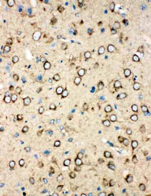 2 - Anti-MTCO1 Antibody ABO10643