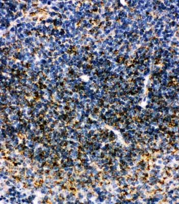 2 - Anti-MTCO1 Antibody ABO10643