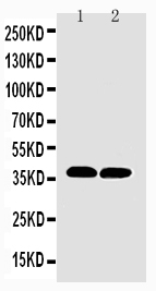 1 - Anti-MTCO1 Antibody ABO10643