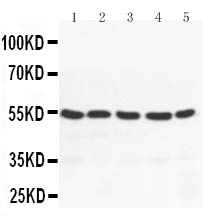 1 - Anti-PPAR Gamma Antibody ABO10645