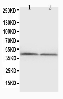 1 - Anti-NPHS2 Antibody ABO10647
