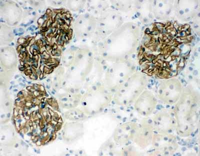 2 - Anti-NPHS2 Antibody ABO10648