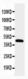 1 - Anti-NPHS2 Antibody ABO10648