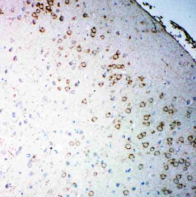 2 - Anti-Muscarinic Acetylcholine Receptor 2 Antibody ABO10651