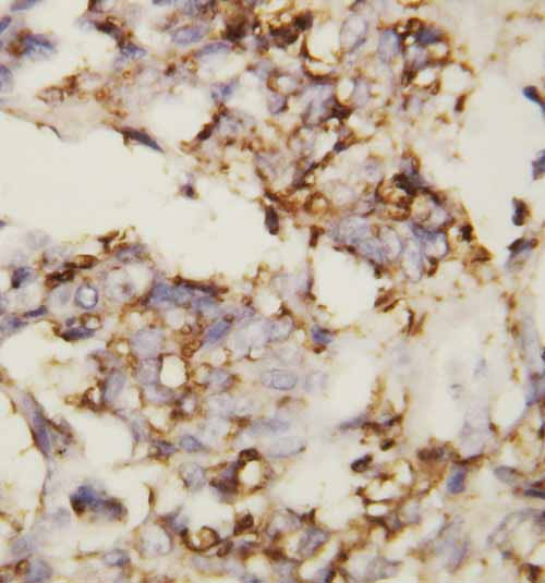 2 - Anti-Cadherin-2/N-Cadherin Antibody ABO10654