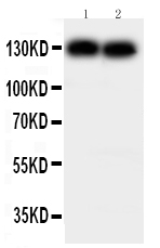 1 - Anti-Cadherin-2/N-Cadherin Antibody ABO10654