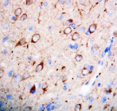 2 - Anti-nNOS(neuronal) Antibody ABO10655