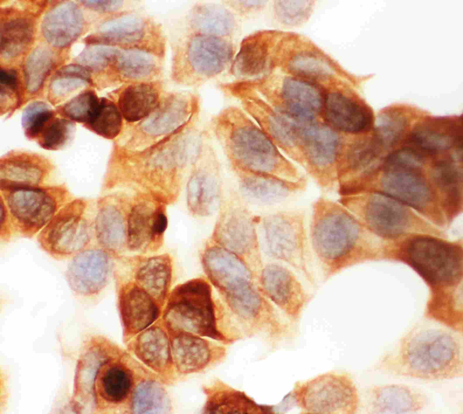 8 - Anti-Cytokeratin 19 Antibody ABO10661