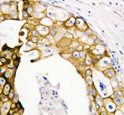 2 - Anti-Cytokeratin 19 Antibody ABO10661