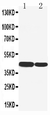 1 - Anti-Cytokeratin 19 Antibody ABO10661