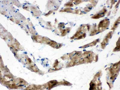 2 - Anti-Cardiac FABP Antibody ABO10662