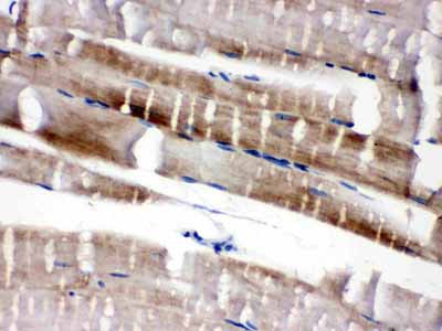 2 - Anti-Cardiac FABP Antibody ABO10662