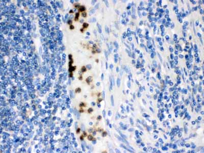 2 - Anti-Cardiac FABP Antibody ABO10662