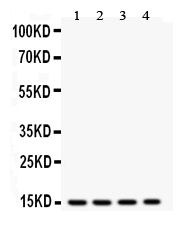 1 - Anti-Cardiac FABP Antibody ABO10662