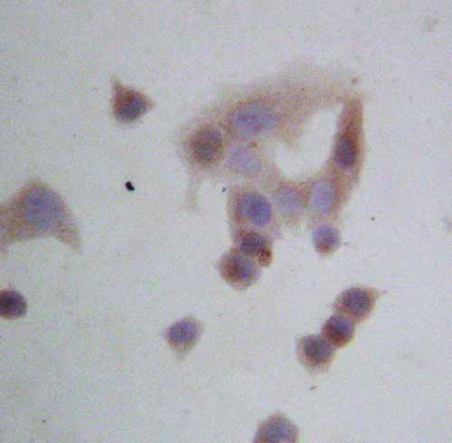 2 - Anti-GRP94 Antibody ABO10665