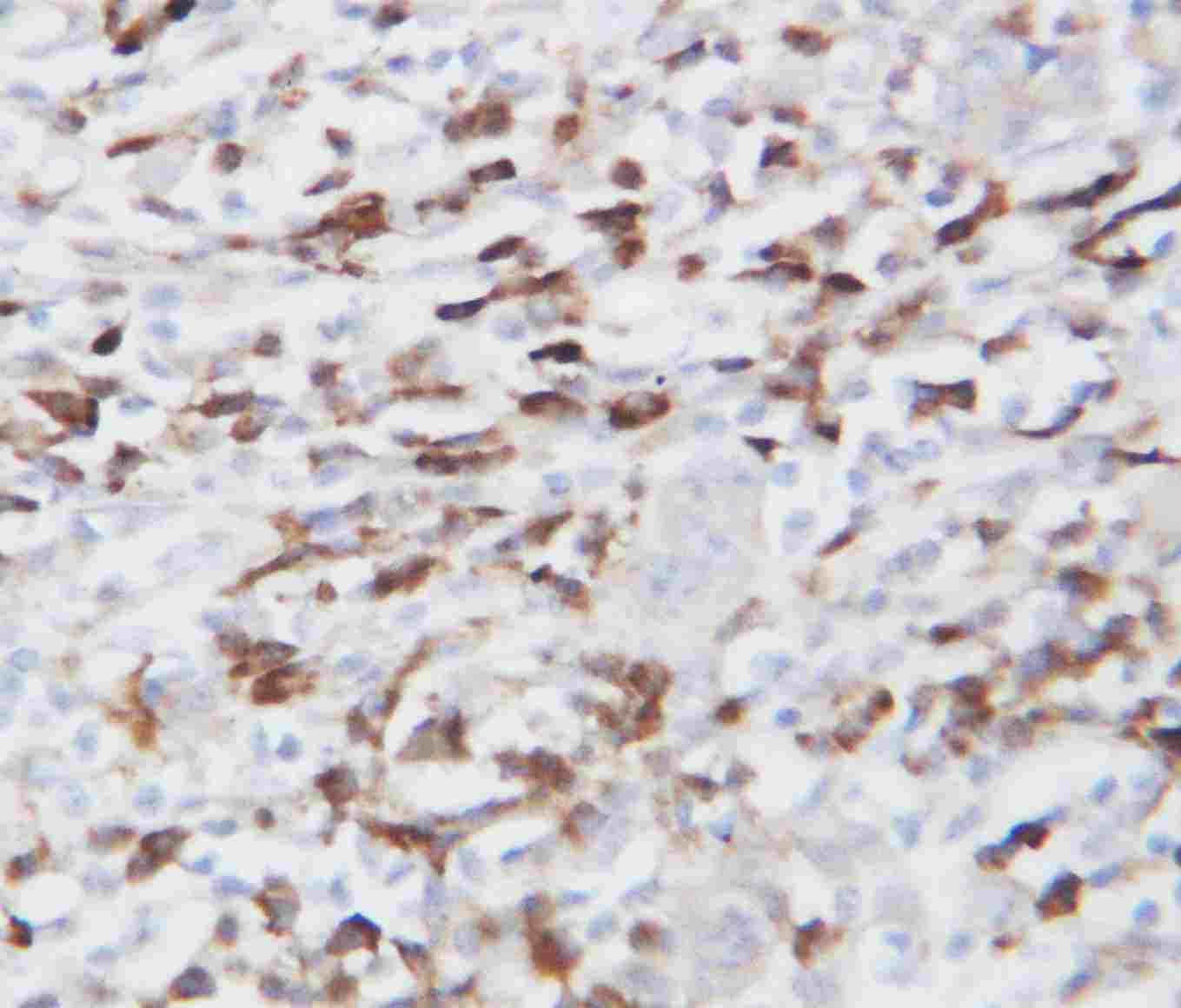 2 - Anti-GRP94 Antibody ABO10665