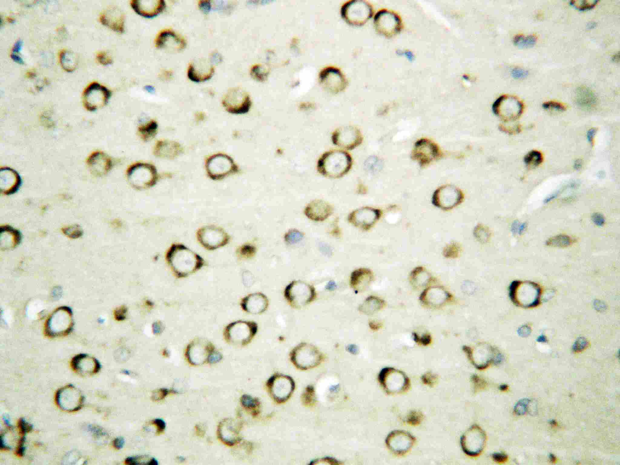 2 - Anti-GRP94 Antibody ABO10665